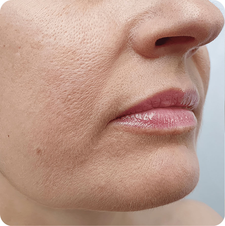 Untitled-2 2-min1 Untitled-2 2-min1