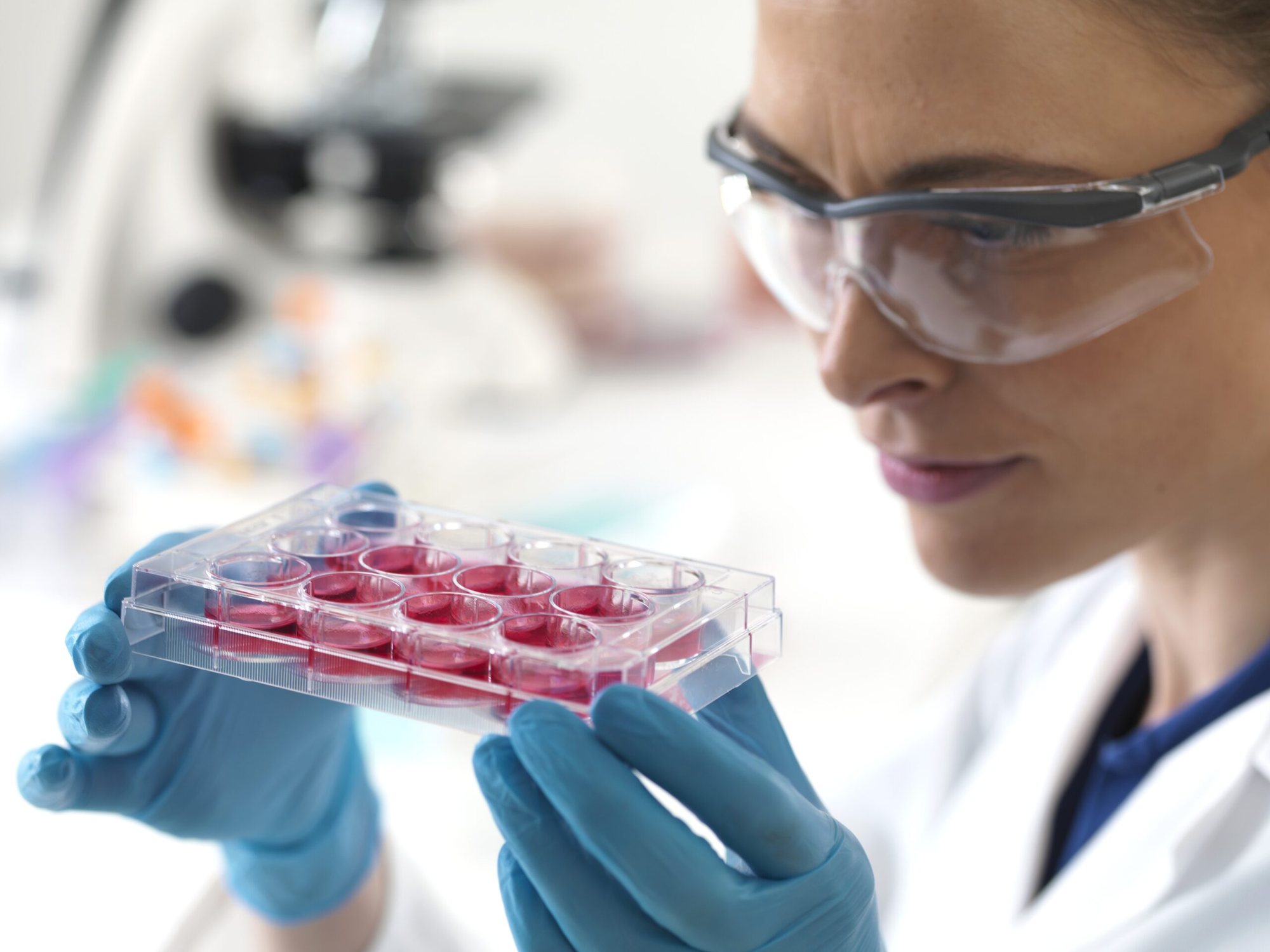 A scientist examining a plate of cultured cells